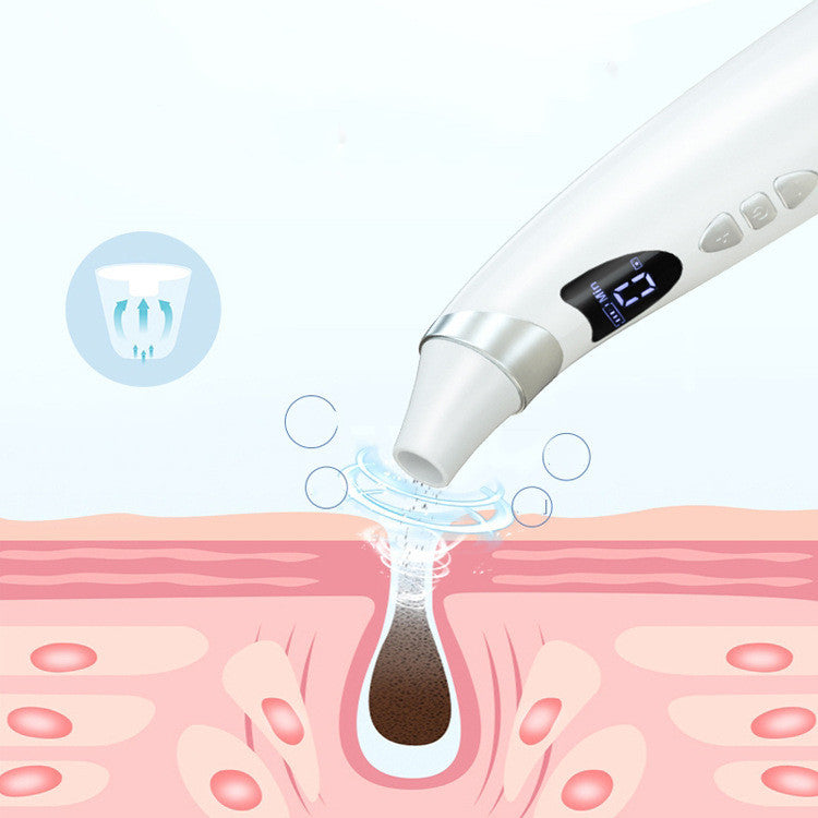 Electric Visual Blackhead Suction Instrument Household Cleansing Pore Cleaner